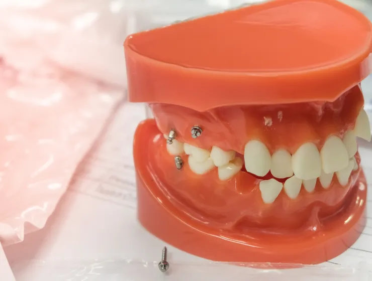 rheinBISS Kieferorthopädie, Dr. Metin Yildiz in Homberg