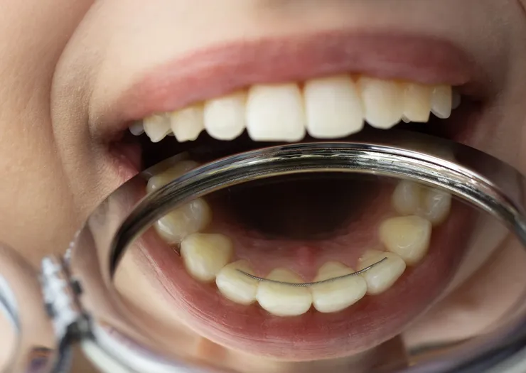 rheinBISS Kieferorthopädie, Dr. Metin Yildiz in Homberg