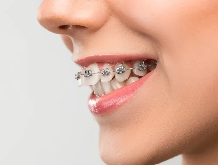 rheinBISS Kieferorthopädie, Dr. Metin Yildiz in Homberg