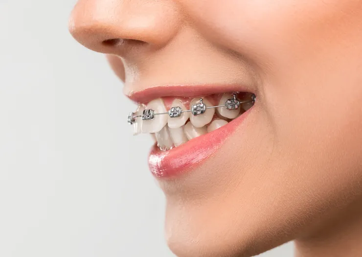 rheinBISS Kieferorthopädie, Dr. Metin Yildiz in Homberg