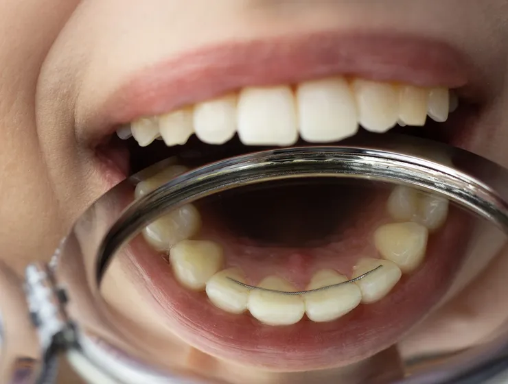 rheinBISS Kieferorthopädie, Dr. Metin Yildiz in Homberg