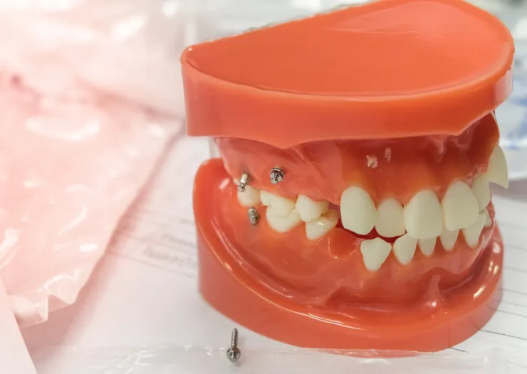 rheinBISS Kieferorthopädie, Dr. Metin Yildiz in Homberg