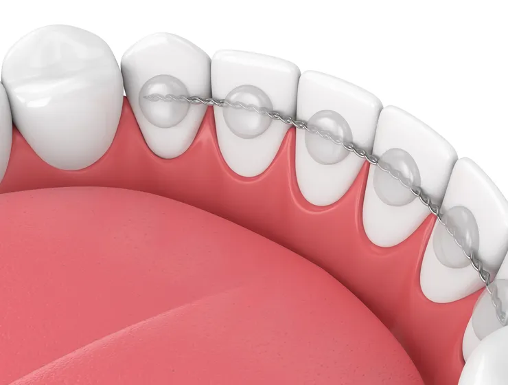 rheinBISS Kieferorthopädie, Dr. Metin Yildiz in Homberg